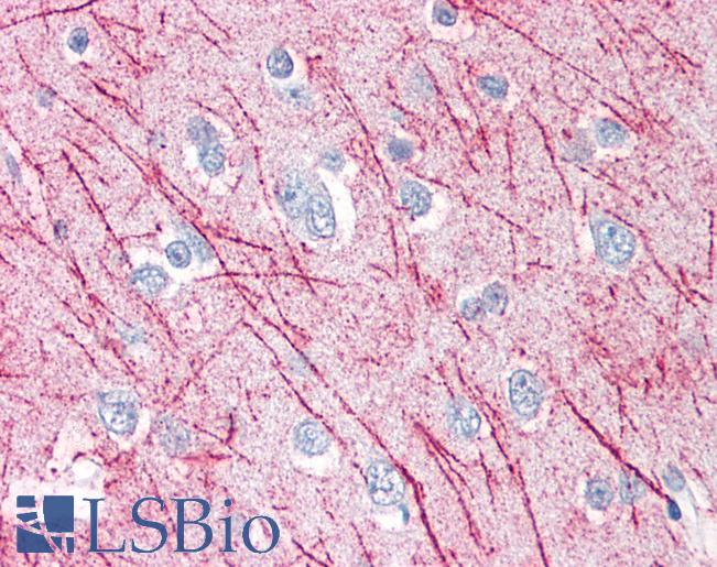 Anti-SRPX2 antibody LS-A9375 IHC of human brain, cortex. Immunohistochemistry of formalin-fixed, paraffin-embedded tissue after heat-induced antigen retrieval.