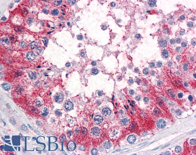 Anti-SRPX2 antibody LS-A9375 IHC of human testis. Immunohistochemistry of formalin-fixed, paraffin-embedded tissue after heat-induced antigen retrieval.