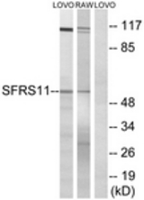 Western blot of extracts from LOVO/RAW264.7 cells, using SFRS11 Antibody. The lane on the right is treated with the synthesized peptide.