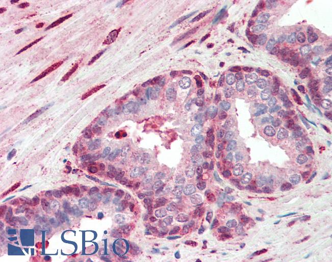 Anti-SRSF2 / SC35 antibody IHC staining of human prostate. Immunohistochemistry of formalin-fixed, paraffin-embedded tissue after heat-induced antigen retrieval. Antibody LS-B9760 concentration 10 ug/ml.