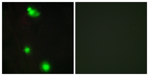 Immunofluorescence of MCF7 cells, using SFRS3 Antibody. The picture on the right is treated with the synthesized peptide.