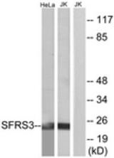 Western blot of extracts from HeLa/Jurkat cells, using SFRS3 Antibody. The lane on the right is treated with the synthesized peptide.