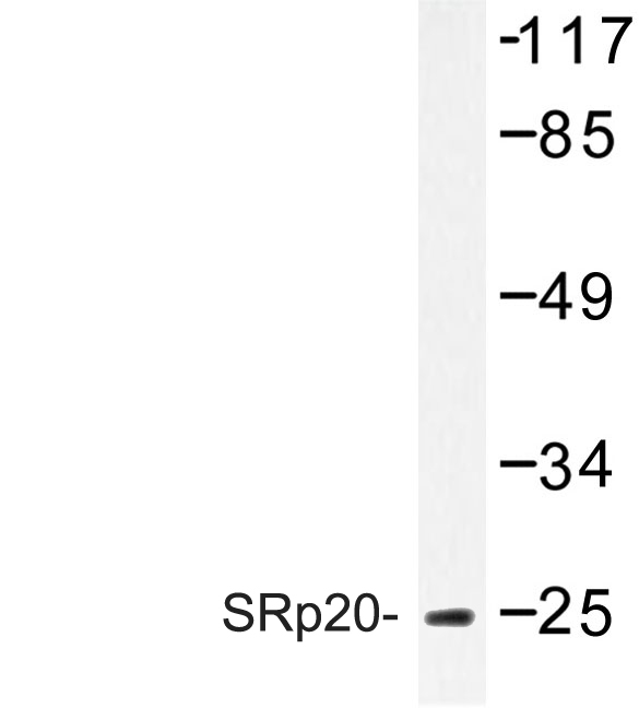 Western blot of SRp20 (F151) pAb in extracts from HeLa.
