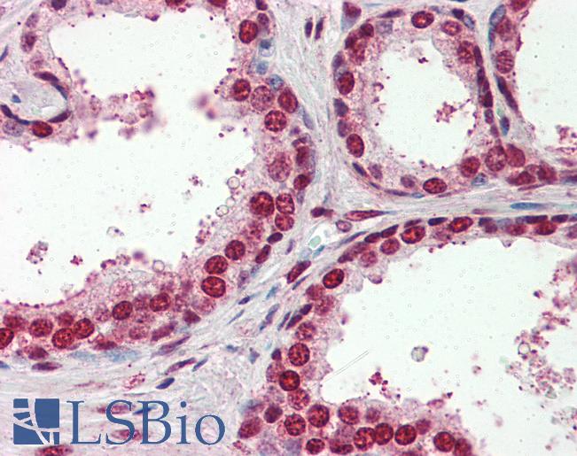 Anti-SRSF4 / SFRS4 antibody IHC of human prostate. Immunohistochemistry of formalin-fixed, paraffin-embedded tissue after heat-induced antigen retrieval. Antibody LS-B3090 concentration 10 ug/ml.