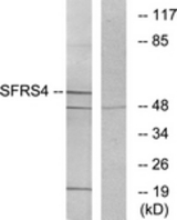 Western blot of extracts from LOVO cells, using SFRS4 Antibody. The lane on the right is treated with the synthesized peptide.