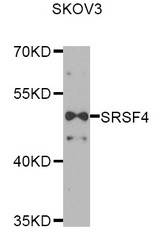 Western blot blot of extracts of SKOV3 cell line, using SRSF4 antibody.