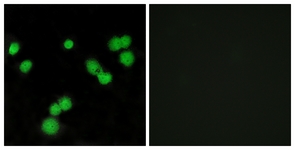 Immunofluorescence of MCF7 cells, using SFRS5 Antibody. The picture on the right is treated with the synthesized peptide.