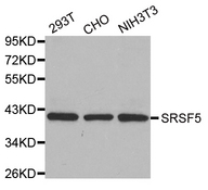 Western blot analysis of extracts of various cell lines, using SRSF5 antibody.