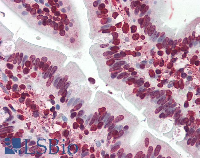 Anti-SRSF5 / SFRS5 antibody IHC of human small intestine. Immunohistochemistry of formalin-fixed, paraffin-embedded tissue after heat-induced antigen retrieval. Antibody LS-B3091 concentration 10 ug/ml.