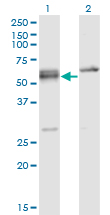 Western blot of SFRS6 expression in transfected 293T cell line by SFRS6 monoclonal antibody (M02), clone 5G6.