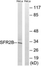 Western blot of extracts from HeLa cells, using SFRS2B Antibody. The lane on the right is treated with the synthesized peptide.