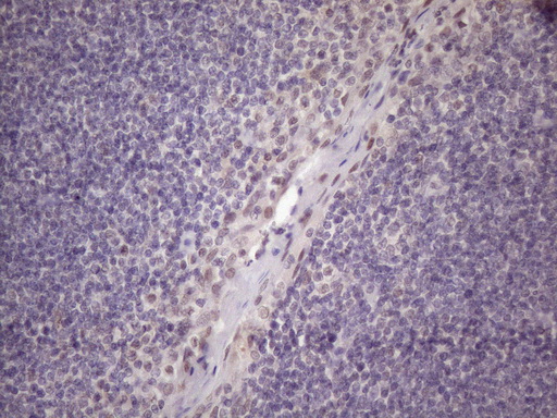 IHC of paraffin-embedded Human tonsil using anti-SRSF9 mouse monoclonal antibody. (Heat-induced epitope retrieval by 1 mM EDTA in 10mM Tris, pH8.5, 120°C for 3min)(1:150).