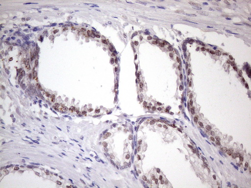 IHC of paraffin-embedded Human prostate tissue using anti-SRSF9 mouse monoclonal antibody. (Heat-induced epitope retrieval by 1 mM EDTA in 10mM Tris, pH8.5, 120°C for 3min)(1:150).