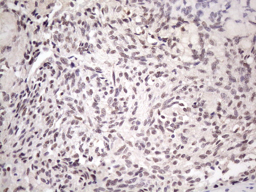 IHC of paraffin-embedded Human thyroid tissue using anti-SRSF9 mouse monoclonal antibody. (Heat-induced epitope retrieval by 1 mM EDTA in 10mM Tris, pH8.5, 120°C for 3min)(1:150).