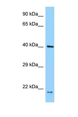 PRPF18 antibody LS-C146121 Western blot of H226 Cell lysate. Antibody concentration 1 ug/ml.