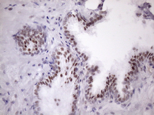 IHC of paraffin-embedded Human prostate tissue using anti-SRSF9 mouse monoclonal antibody. (Heat-induced epitope retrieval by Tris-EDTA, pH8.0)(1:150).