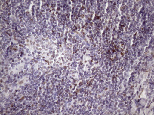 IHC of paraffin-embedded Human lymph node tissue using anti-SRSF9 mouse monoclonal antibody. (Heat-induced epitope retrieval by Tris-EDTA, pH8.0)(1:150).