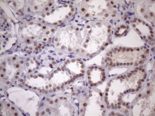 IHC of paraffin-embedded Human Kidney tissue using anti-SRSF9 mouse monoclonal antibody. (Heat-induced epitope retrieval by Tris-EDTA, pH8.0)(1:150).