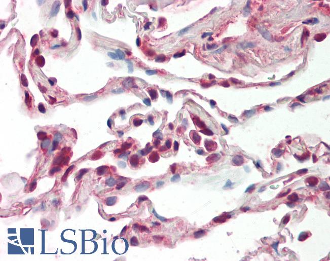 Anti-SRSF9 / SFRS9 antibody IHC staining of human lung. Immunohistochemistry of formalin-fixed, paraffin-embedded tissue after heat-induced antigen retrieval. Antibody LS-B11480 concentration 10 ug/ml.