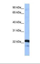 Placenta cell lysate. Antibody concentration: 1.0 ug/ml. Gel concentration: 12%.