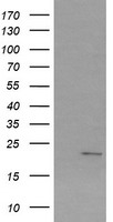 HEK293T cells were transfected with the pCMV6-ENTRY control (Left lane) or pCMV6-ENTRY SRY (Right lane) cDNA for 48 hrs and lysed. Equivalent amounts of cell lysates (5 ug per lane) were separated by SDS-PAGE and immunoblotted with anti-SRY.