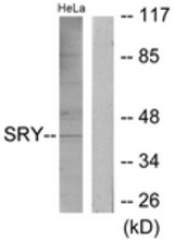Western blot of extracts from HeLa cells, using SRY Antibody. The lane on the right is treated with the synthesized peptide.