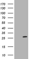 HEK293T cells were transfected with the pCMV6-ENTRY control (Left lane) or pCMV6-ENTRY SRY (Right lane) cDNA for 48 hrs and lysed. Equivalent amounts of cell lysates (5 ug per lane) were separated by SDS-PAGE and immunoblotted with anti-SRY.