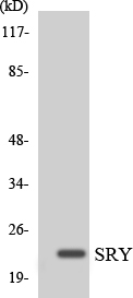 Western blot of the lysates from K562 cells using SRY antibody.