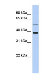 SS18L1 antibody LS-C111750 Western blot of Jurkat lysate.