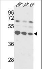 Western blot of SSB Antibody in K562, HeLa, 293 cell line lysates (35 ug/lane). SSB (arrow) was detected using the purified antibody.