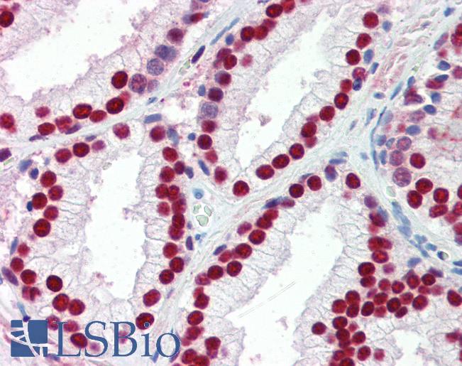 Anti-SSB antibody IHC of human prostate. Immunohistochemistry of formalin-fixed, paraffin-embedded tissue after heat-induced antigen retrieval. Antibody LS-B3540 concentration 5 ug/ml.