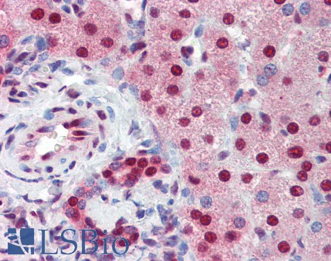 Anti-SSB antibody IHC of human liver. Immunohistochemistry of formalin-fixed, paraffin-embedded tissue after heat-induced antigen retrieval. Antibody LS-B3540 concentration 5 ug/ml.