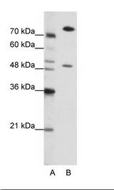 A: Marker, B: Jurkat Cell Lysate.