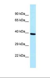 Western blot of Human Placenta . PRPF18 antibody dilution 1.0 ug/ml.