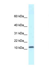 SSBP1 antibody LS-C145580 Western blot of Fetal Kidney lysate. Antibody concentration 1 ug/ml.