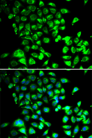 Immunofluorescence blot of U20S cell using SSBP1 antibody. Blue: DAPI for nuclear staining.