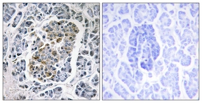 IHC of paraffin-embedded human pancreas tissue, using MtSSB Antibody. The picture on the right is treated with the synthesized peptide.