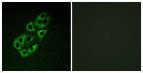 Immunofluorescence of A549 cells, using MtSSB Antibody. The picture on the right is treated with the synthesized peptide.