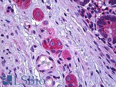 Anti-SSBP2 antibody IHC of human intestine, ganglion cells. Immunohistochemistry of formalin-fixed, paraffin-embedded tissue after heat-induced antigen retrieval. Antibody LS-B5667 concentration 10 ug/ml.