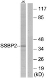 Western blot of extracts from Jurkat cells, using SSBP2 Antibody. The lane on the right is treated with the synthesized peptide.