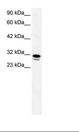 Raji Cell Lysate.