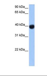 Transfected 293T cell lysate. Antibody concentration: 1.0 ug/ml. Gel concentration: 12%.