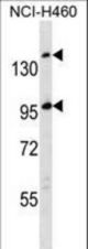SSC5D Antibody western blot of NCI-H460 cell line lysates (35 ug/lane). The SSC5D antibody detected the SSC5D protein (arrow).