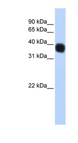SSBP3 antibody LS-C102619 Western blot of MCF7 cell lysate.