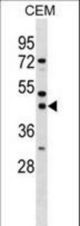 SSBP3 Antibody western blot of CEM cell line lysates (35 ug/lane). The SSBP3 antibody detected the SSBP3 protein (arrow).