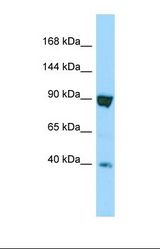 Western blot of Human HT1080. SSFA2 antibody dilution 1.0 ug/ml.