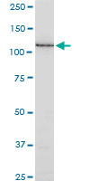 SSH1 monoclonal antibody (M02), clone 1D2. Western blot of SSH1 expression in HeLa.