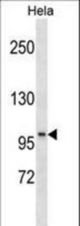 SSH1 Antibody western blot of HeLa cell line lysates (35 ug/lane). The SSH1 antibody detected the SSH1 protein (arrow).
