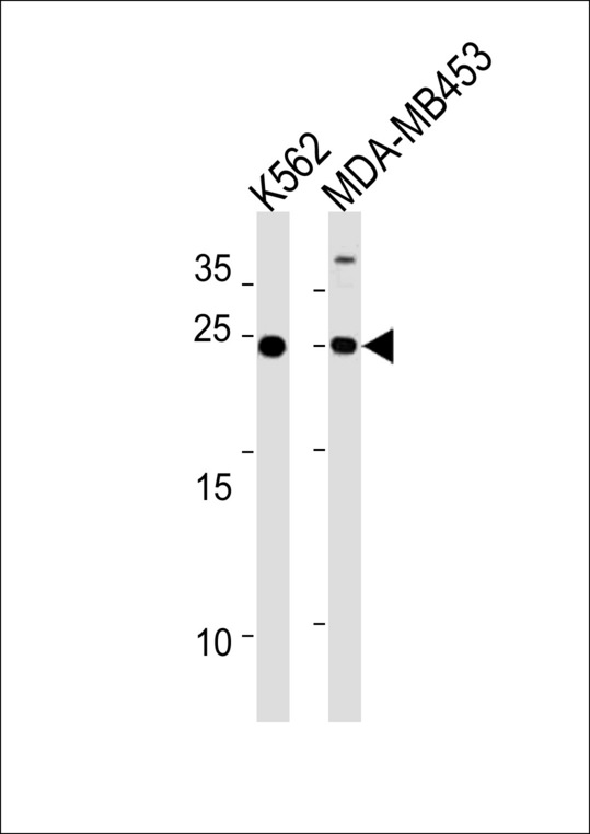 SSPN Antibody western blot of K562,MDA-MB453 cell line lysates (35 ug/lane). The SSPN antibody detected the SSPN protein (arrow).