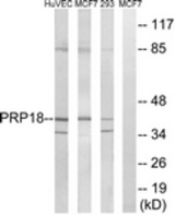 Western blot of extracts from 293/MCF-7/HUVEC cells, using PRPF18 Antibody. The lane on the right is treated with the synthesized peptide.